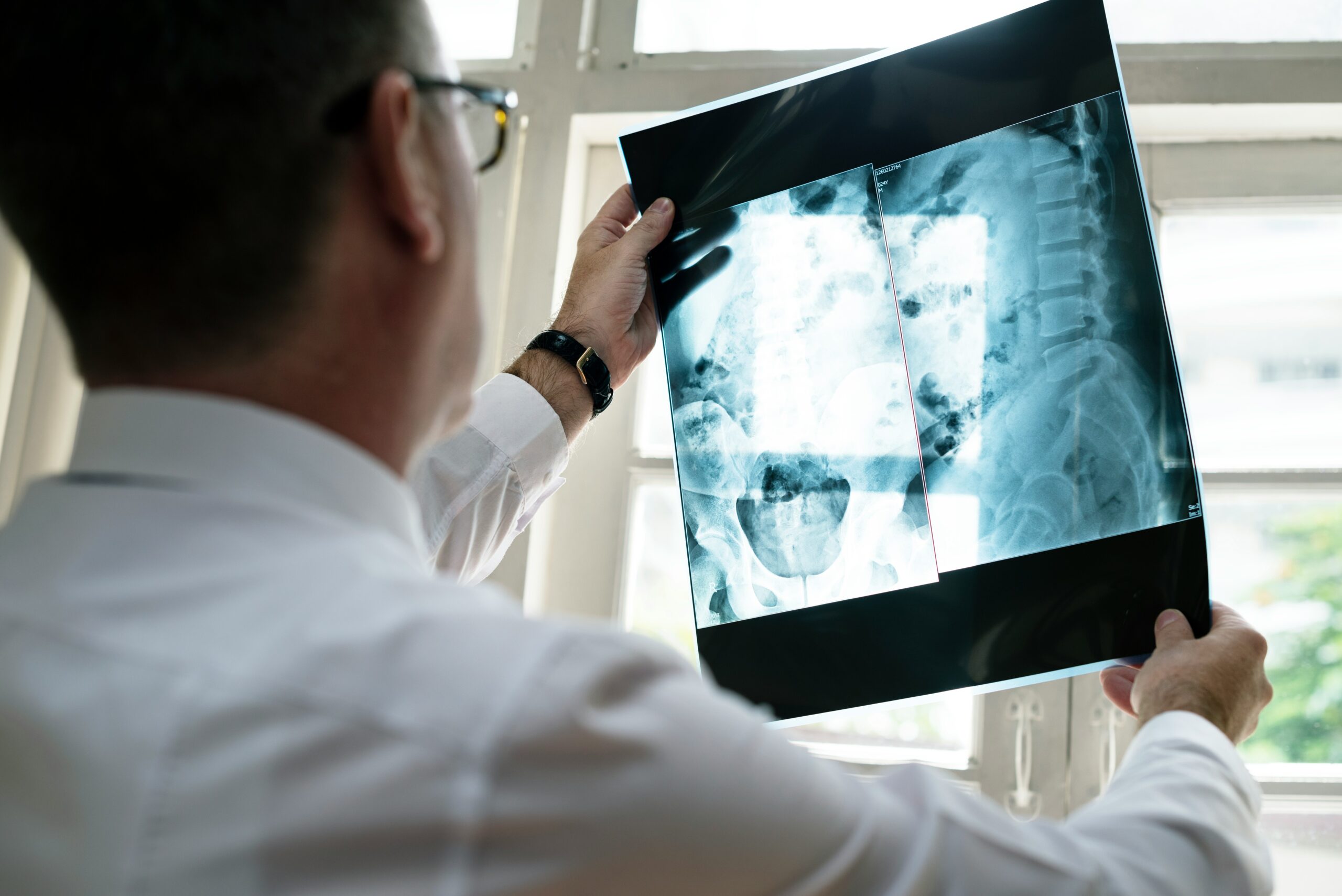 A man holds an X-ray image, examining it closely for medical analysis.