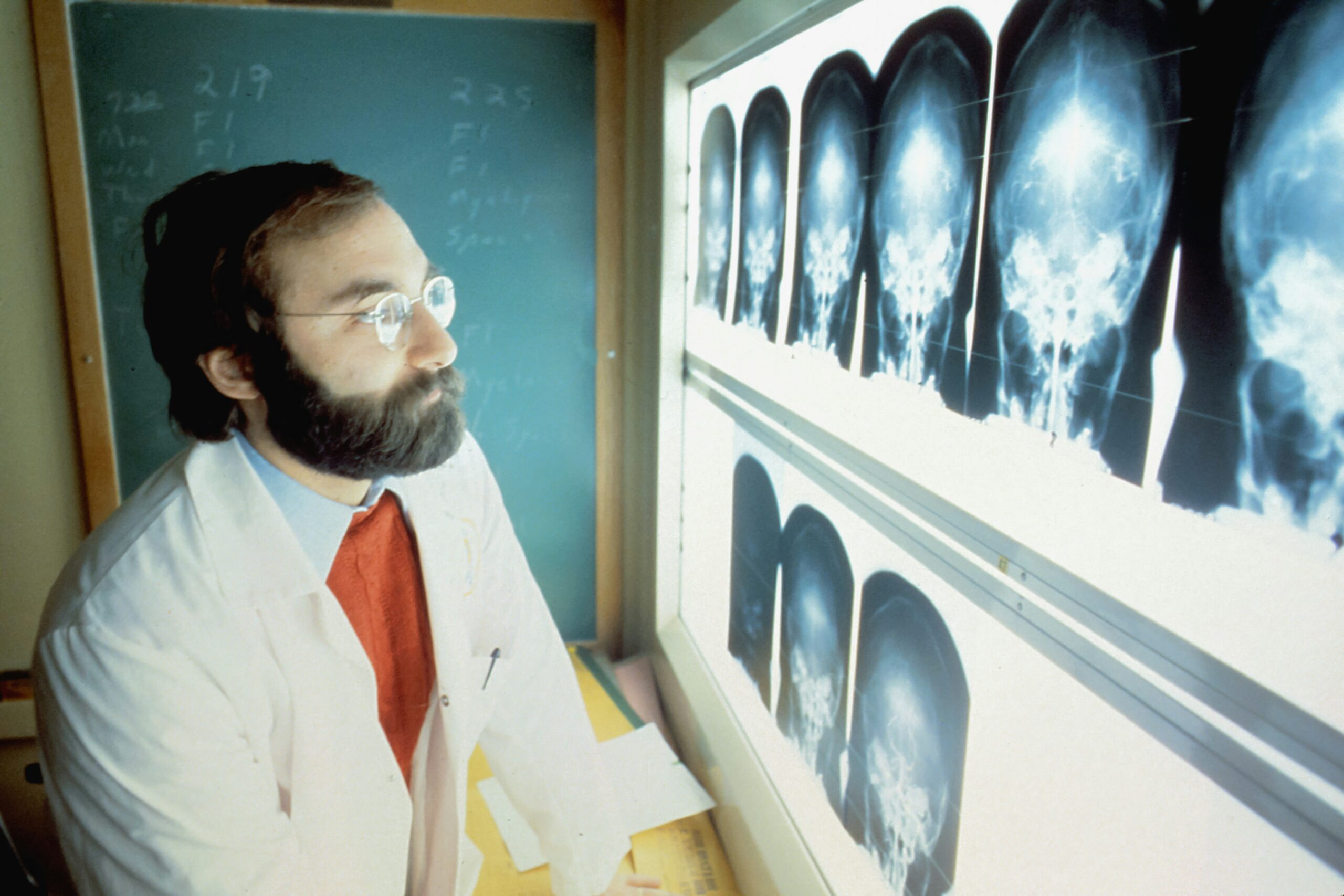 A man in a lab coat and glasses examines an x-ray image with a focused expression.
